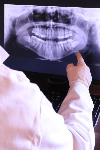Best Emergency Tooth Extraction in Vineyards, FL