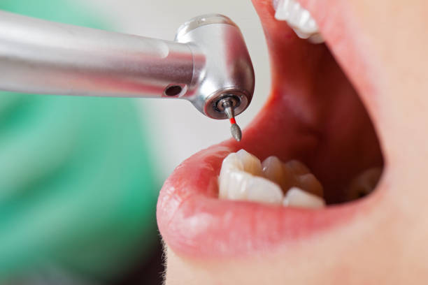 Best Emergency Treatment for Dental Infections or Abscesses in Vineyards, FL